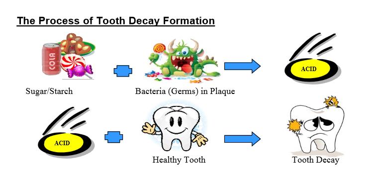 Oral Health and Dental Caries ! - Public Health Notes