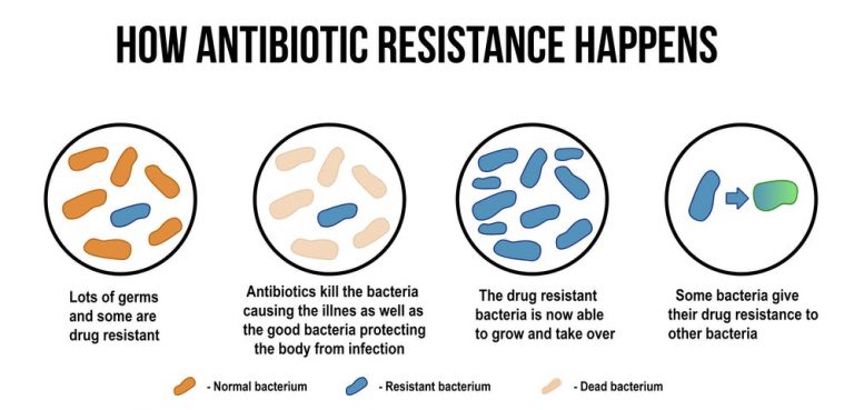 kneten-kino-investieren-mechanism-of-antibiotic-resistance-pdf-banjo