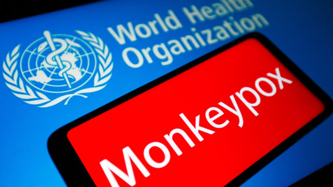 Q&A: What you need to know about monkeypox