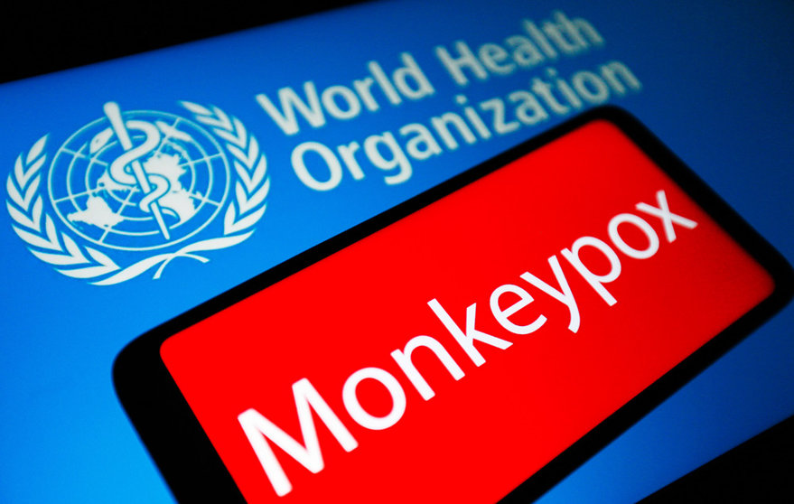 Your Monkeypox Questions Answered