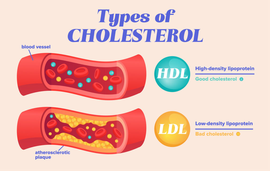 cholesterol-types-importance-prevention-treatment-public-health