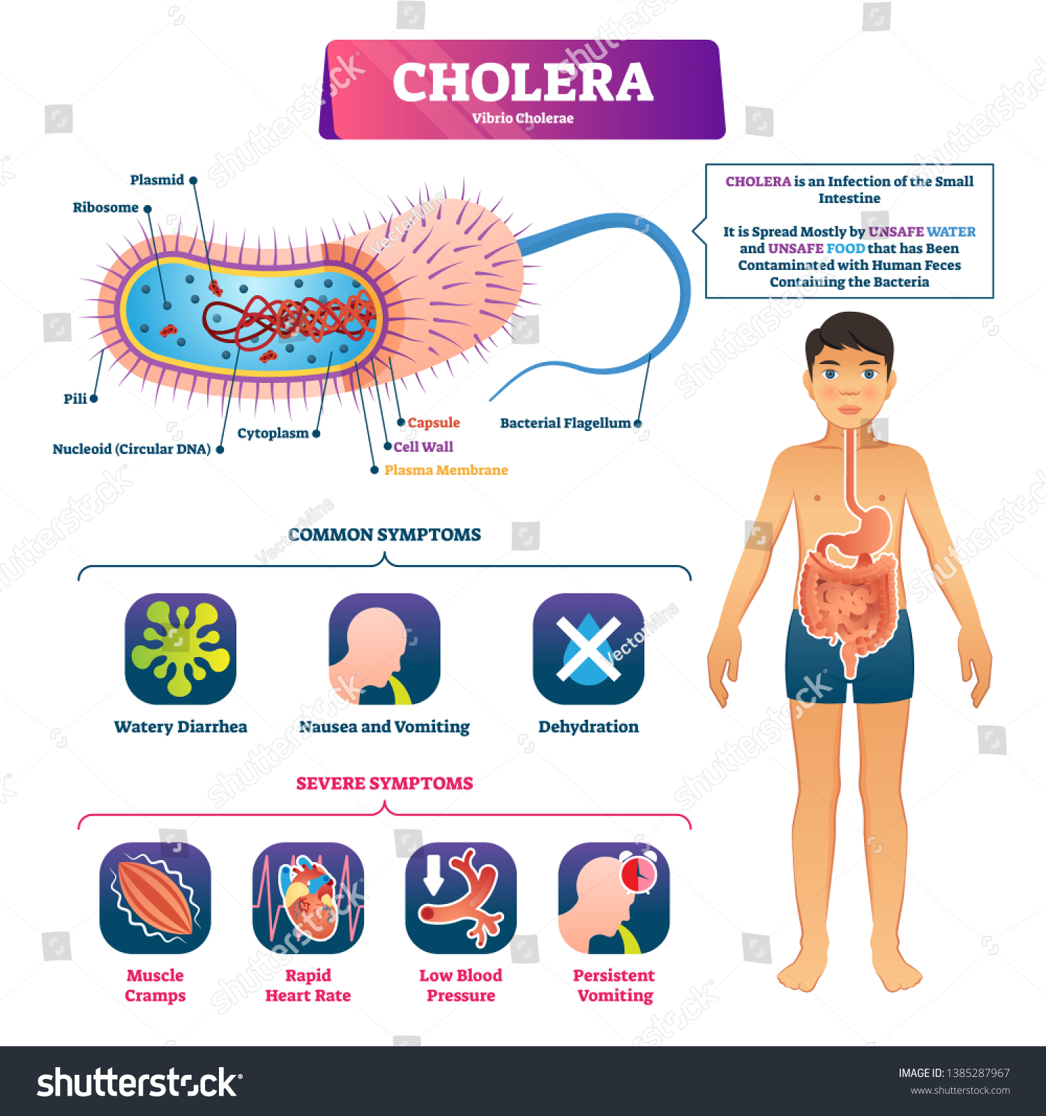 cholera symptoms and prevention