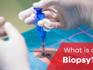 biopsy
