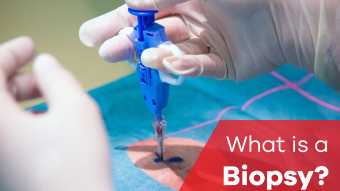what-is-biopsy-768x511-1 biopsy