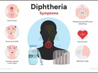 Diphtheria