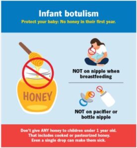 Infant Botulism
