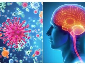 Meningococcal meningitis