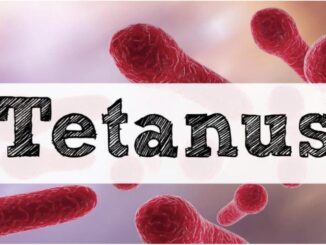 tetanus