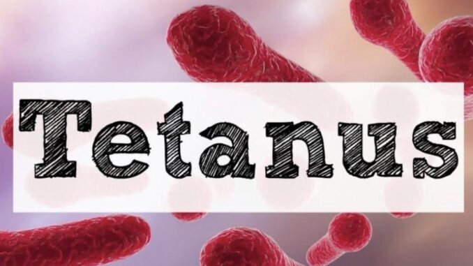 tetanus