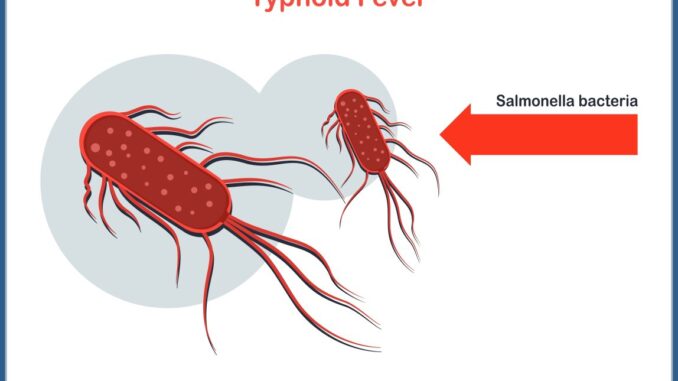 Typhoid fever